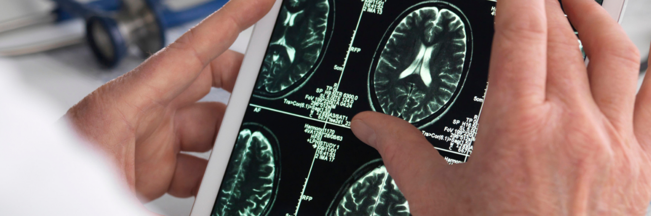neuropsicologia